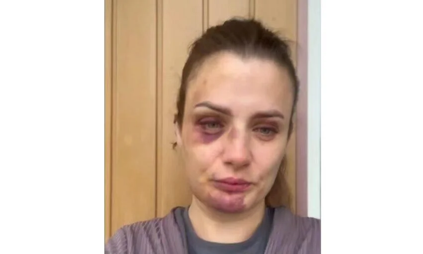 В Калининграде мужчина похитил бывшую жену и два часа избивал её в машине. Полиция три года закрывает глаза на домашнее насилие